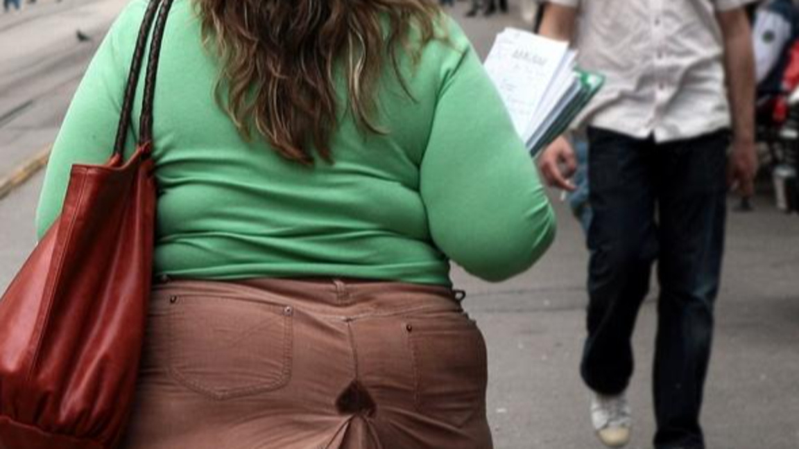 За затлъстяването като здравен и икономи...