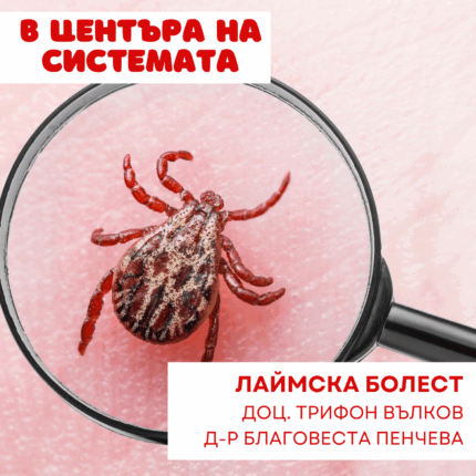 Лаймска болест