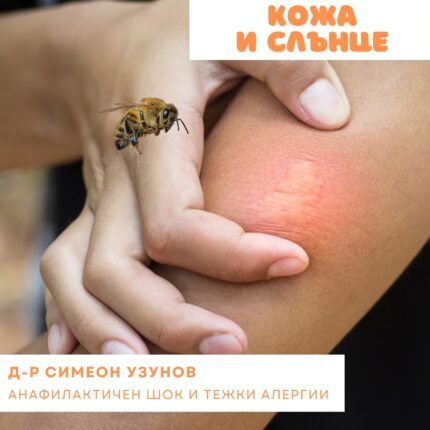 Алергия след ужилване от инсекти